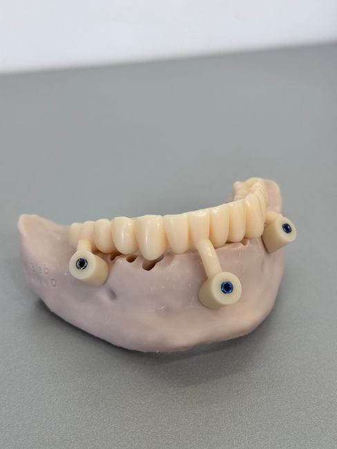 implant post op instructions